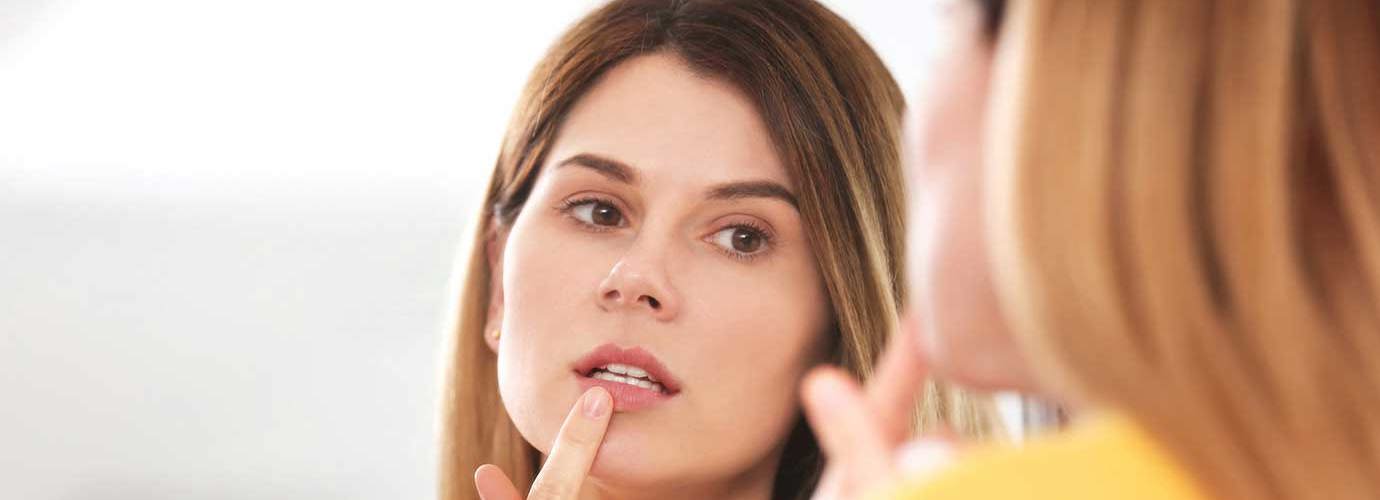 Eine Frau behandelt einen Lippenherpes vor einem Spiegel