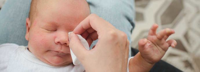 Ein Elternteil reinigt die verklepten Augen eines Babys